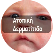 Atopiki New