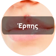 Erpis New