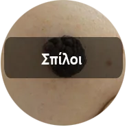 Spiloi 1