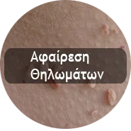 Thilomata1